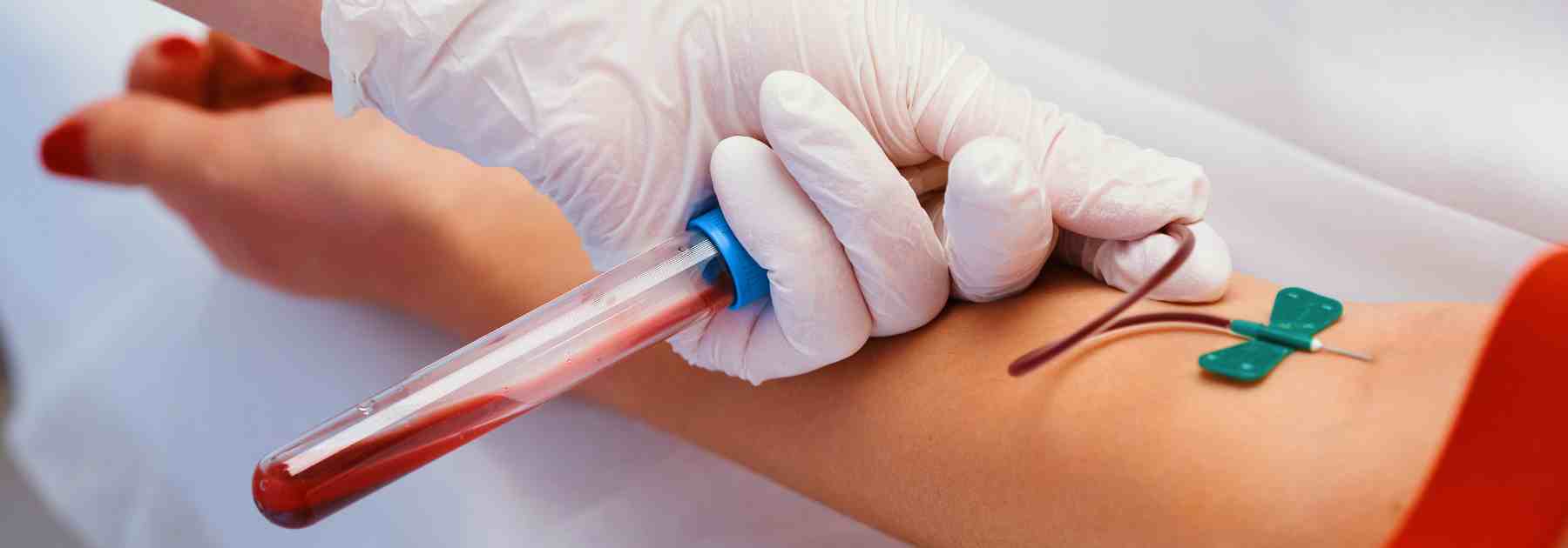 Access blood testing and phlebotomy in Peacehaven.
